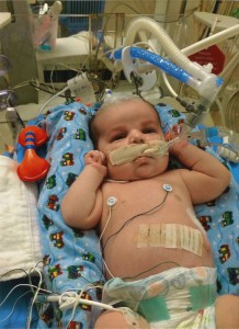 Rocco lays in a hospital bed. He's hooked up to multiple machines by wires and a tube in his mouth.