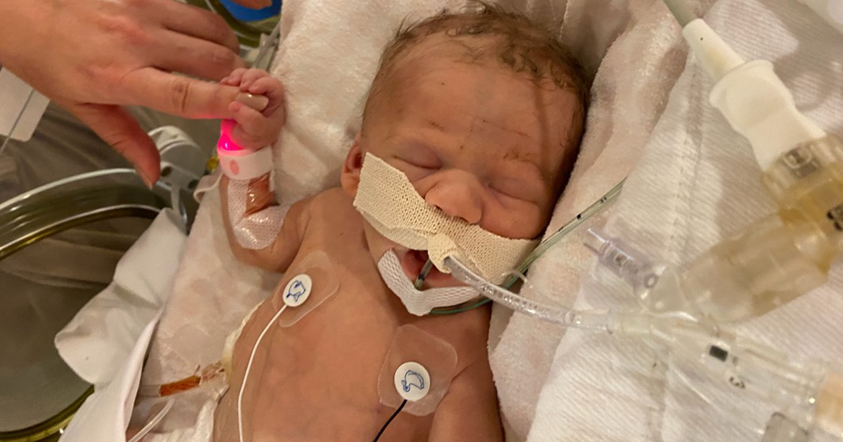 Beating the odds and navigating the unknowns baby Aria’s story The