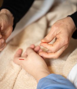 Integrative medicine being done on a patient